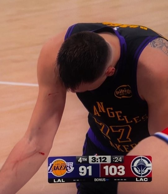 lol外围-谁抓的~东契奇罚球时看向手臂 好几道伤口&amp;血迹斑斑